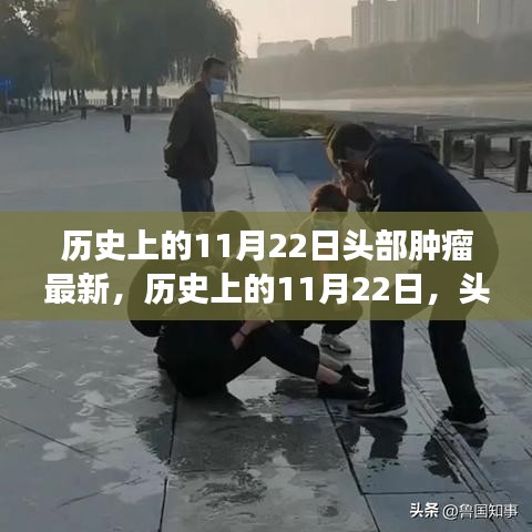 历史上的11月22日头部肿瘤最新，历史上的11月22日，头部肿瘤研究的突破性进展