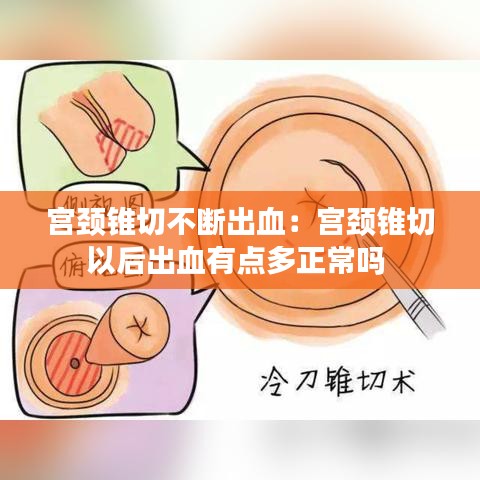 宫颈锥切不断出血：宫颈锥切以后出血有点多正常吗 