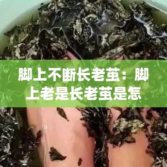 脚上不断长老茧：脚上老是长老茧是怎么回事? 