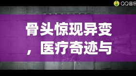 骨头惊现异变，医疗奇迹与挑战的探索之旅