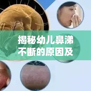 揭秘幼儿鼻涕不断的原因及应对妙招