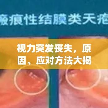 视力突发丧失，原因、应对方法大揭秘，有效预防是关键！