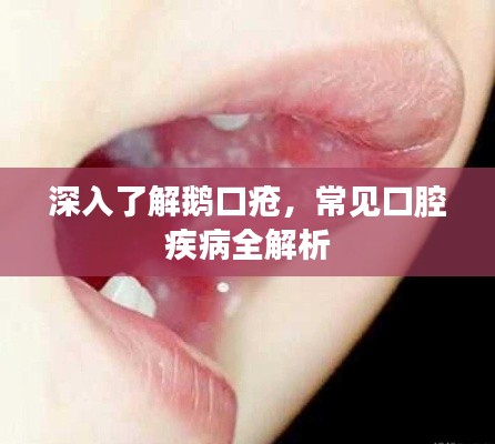 蹑蹻檐簦