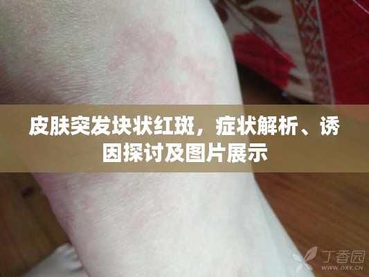 束手就禽
