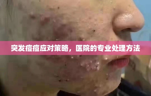 突发痘痘应对策略，医院的专业处理方法